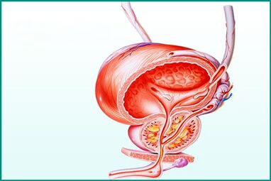 急性前列腺炎中的前列腺炎症是性生活的限制